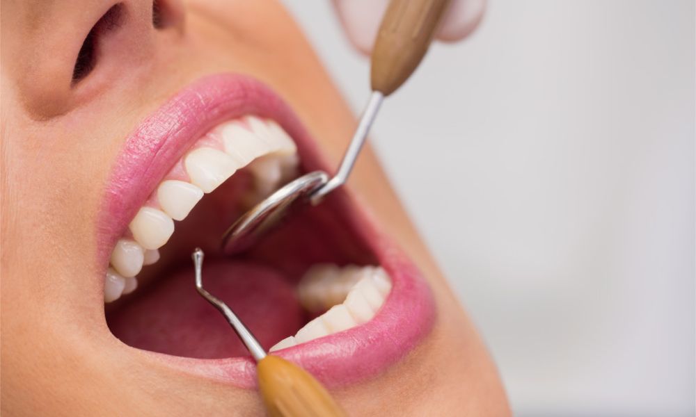 COLSANITAS PLAN DENTAL