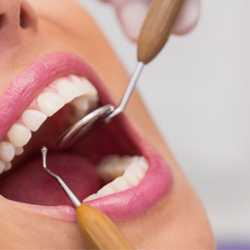 Colsanitas Plan Dental