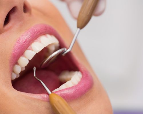 COLSANITAS PLAN DENTAL